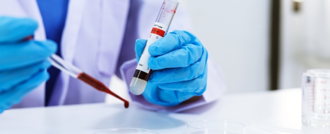 Private Blood Test in Milton Keynes