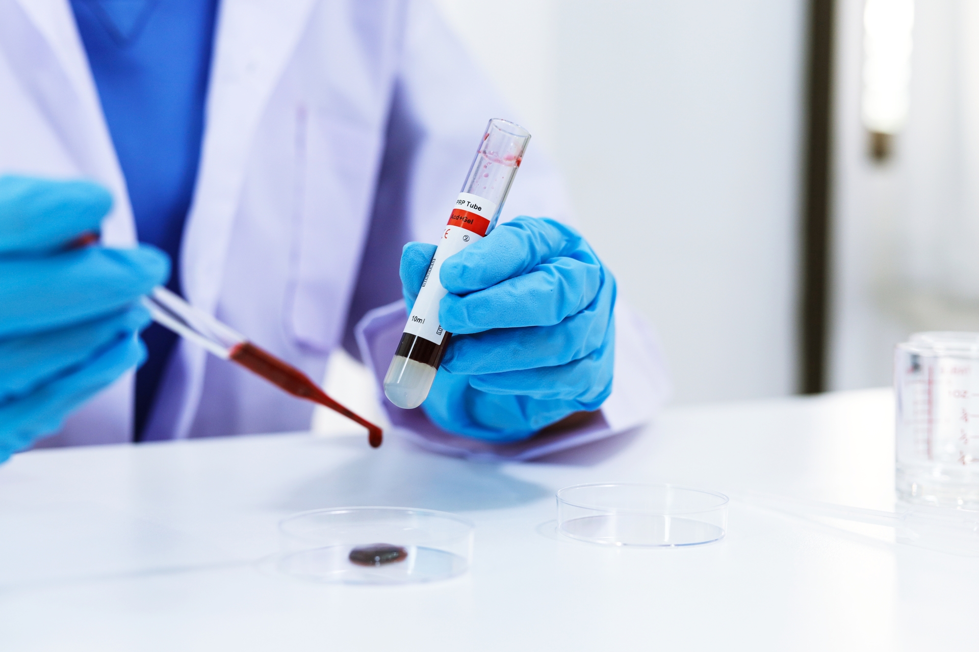 Private Blood Test in Milton Keynes